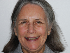 Whitening Before and After