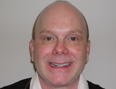 Veneers Before and After